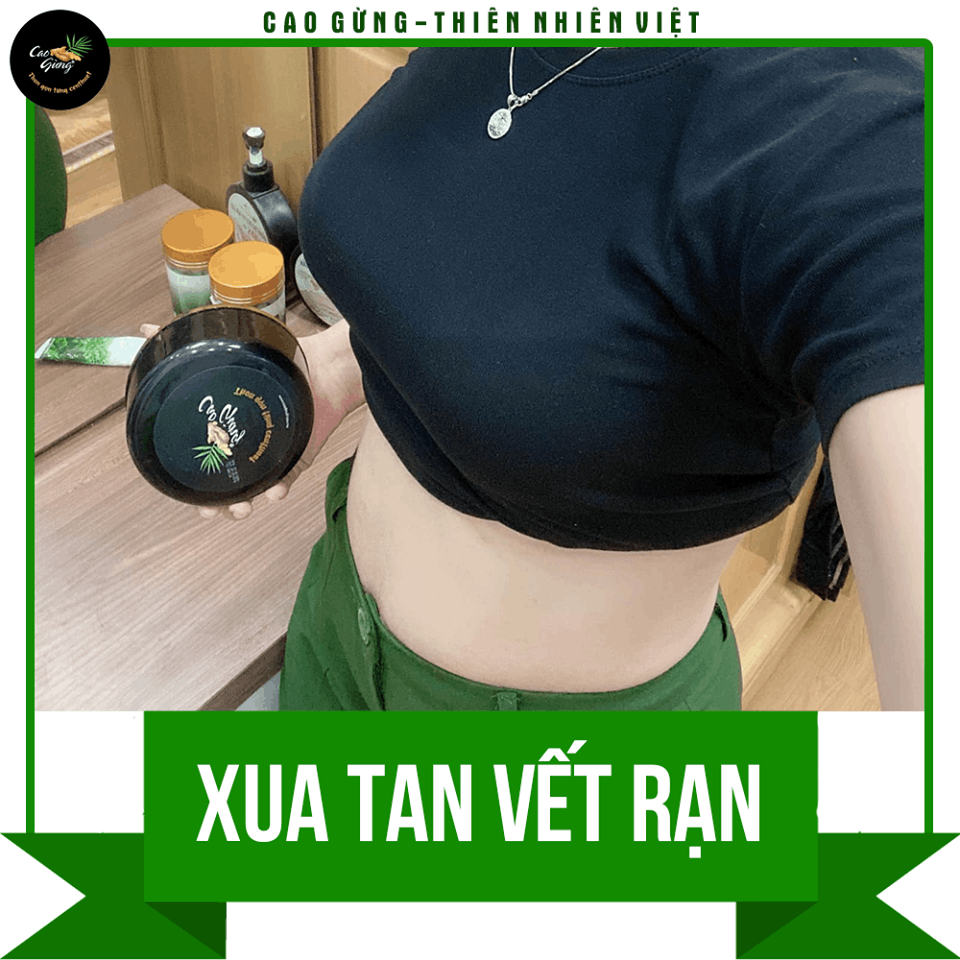 14329-cg165-4-11.png Cao Gừng Tan Mỡ Bụng Thiên Nhiên Việt 250g Phiên Bản 2025 - Tặng Cao Gừng Nghệ Đỏ - 8936079033002