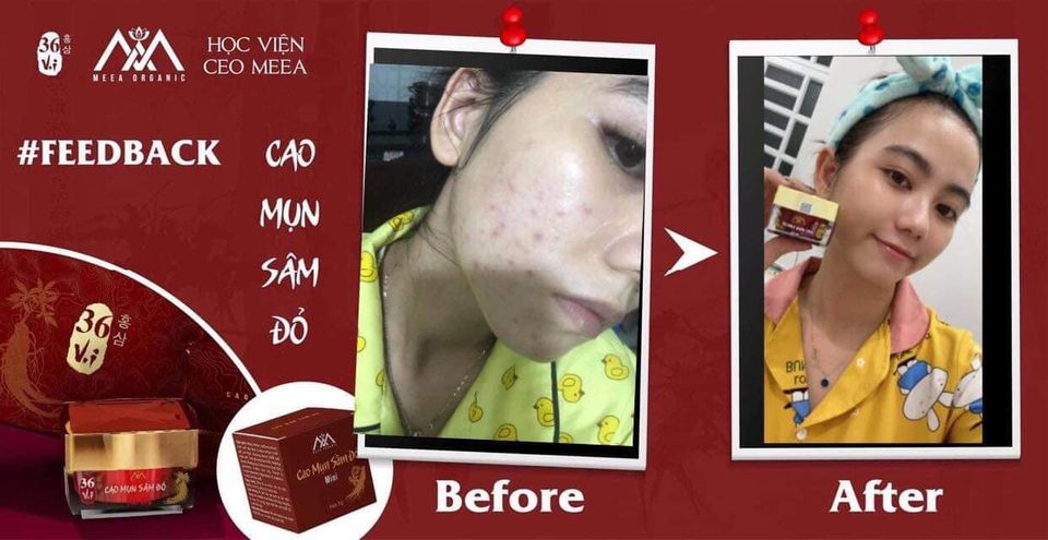 14330-csf210-3-8.jpg Cao Mụn Sâm Đỏ 36 Vị MeeA Organic Loại Lớn 15g - 8938534672009