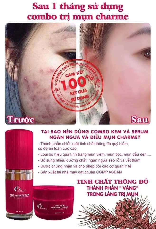19229-z4294569949526-766be75f00e5ea2fd5e6be4bfc43c98e-2.jpg Kem Face Mụn Hàn Quốc Charme Anti Acne Whitening Cream - 8809273480210