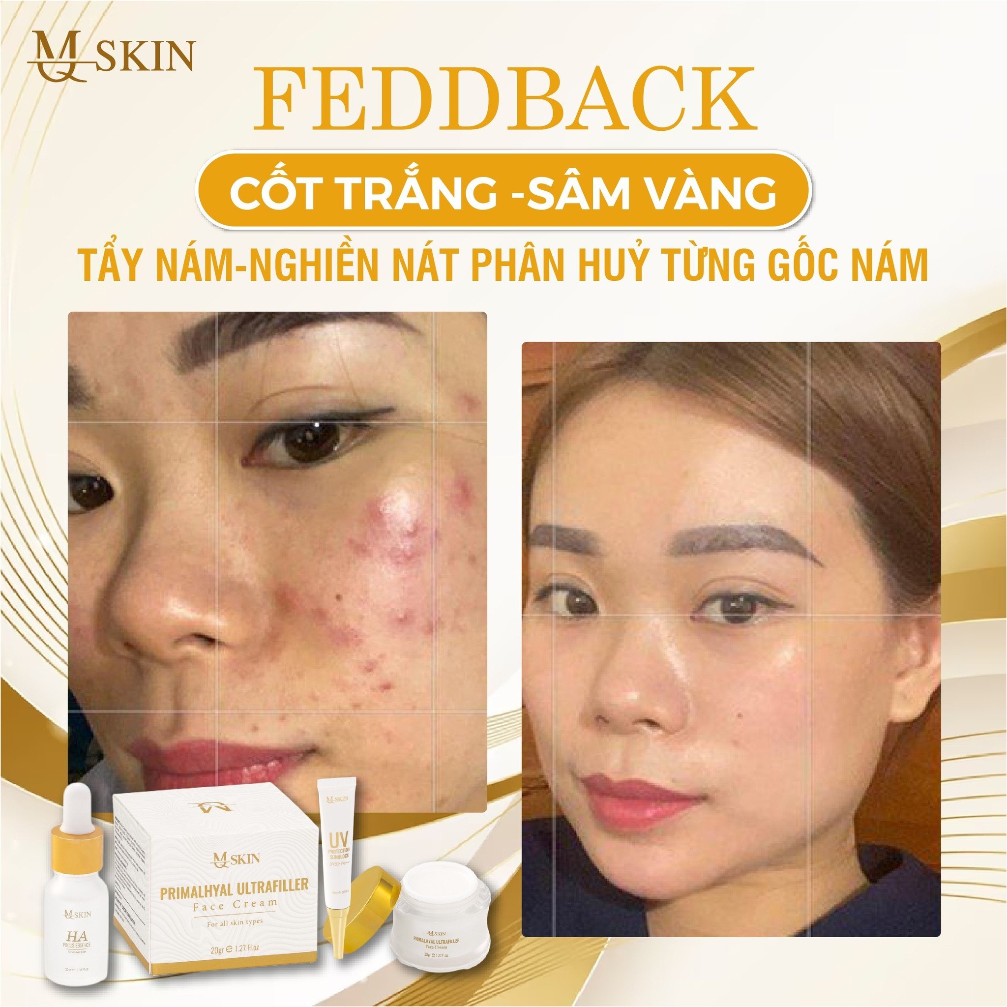 21608-357689205-570342548605925-5308711782493165650-n-2.jpg Combo Kem Face Sâm Vàng MQ Skin - CBFACEMQSKIN01