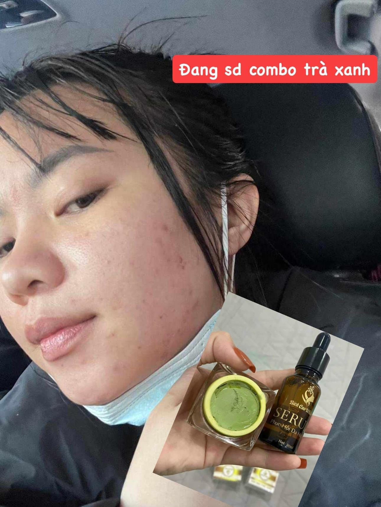 24442_441872286-425708603559890-3493862078526370094-n_20240601104002-1.jpg Kem Face Nám Thảo Dược Bích Cao White Hộp Màu Tím - 8936197120028