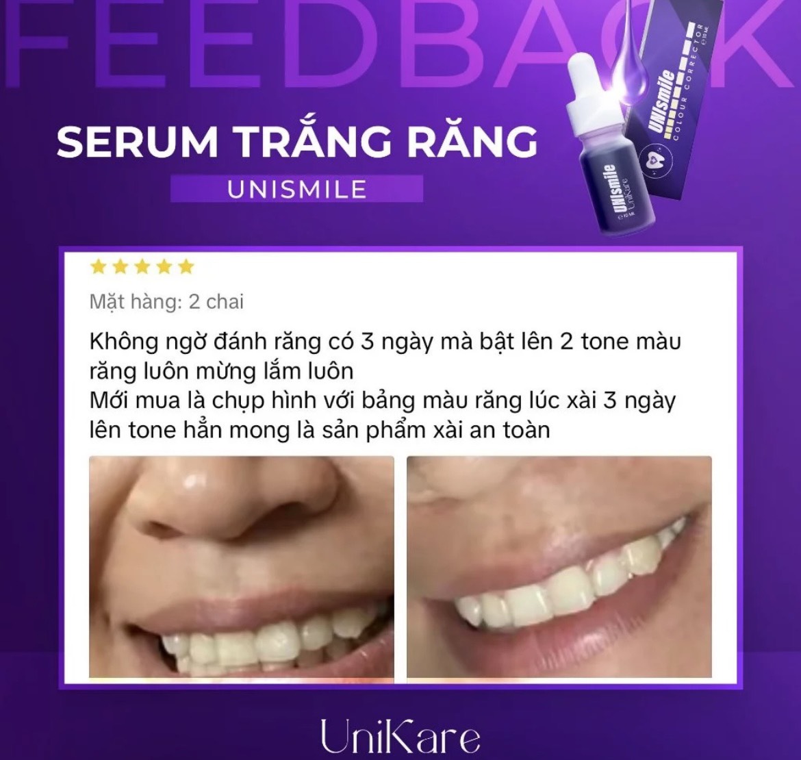24535_z5537365845403-4273010c864a0ef83b8d71f40ef8aea9_20240614160845-6.jpg Serum Trắng Răng Unismile Unikare 10ml - SRUNISMILE01