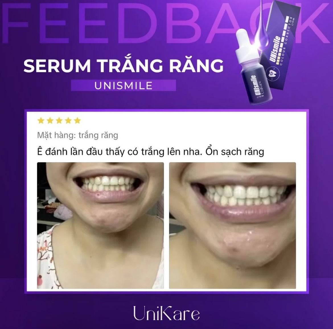 24535_z5537365860233-d2c5e76cd9eb49a837c40619ed6c761a-1_20240614160846-6.jpg Serum Trắng Răng Unismile Unikare 10ml - SRUNISMILE01