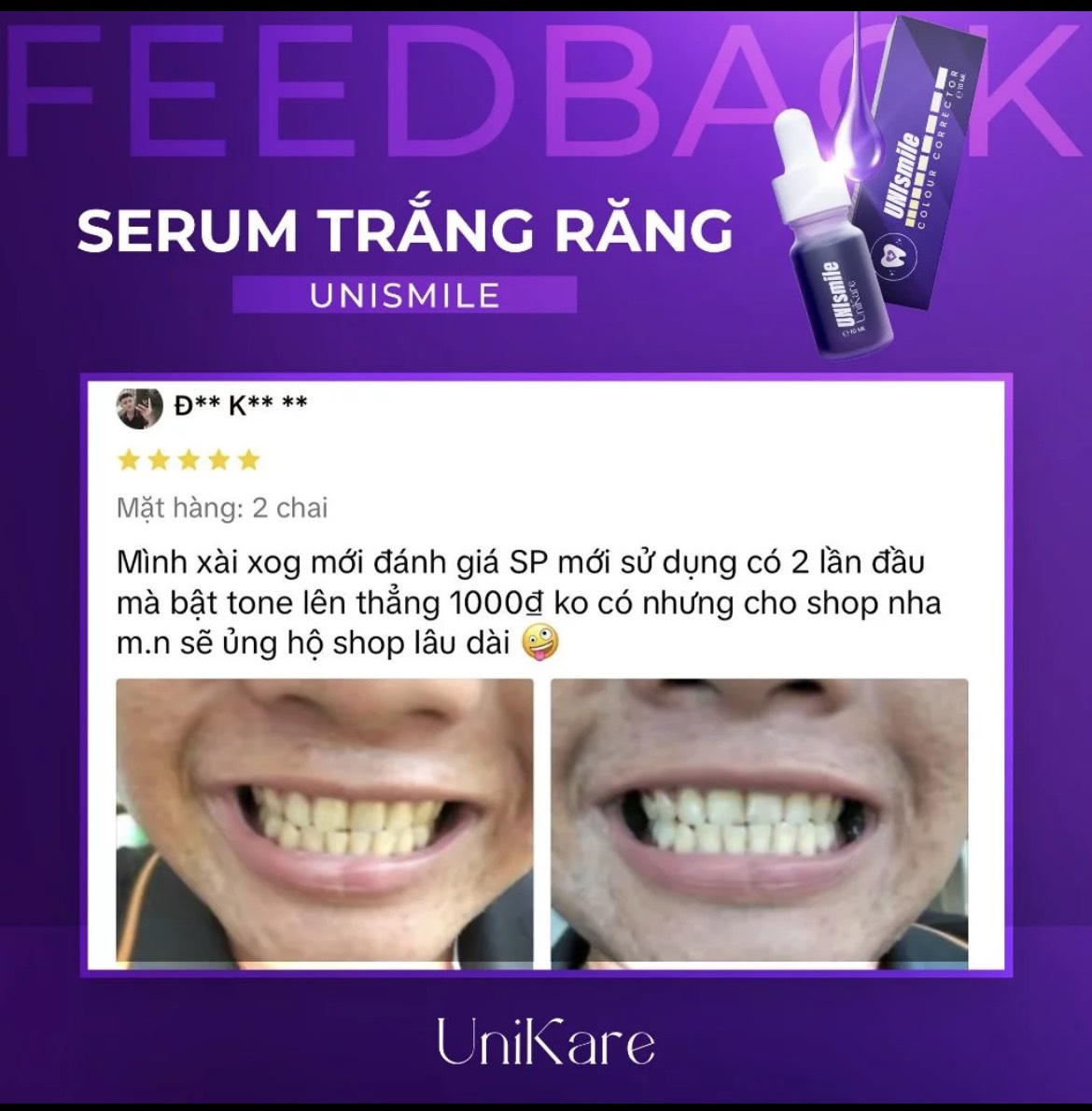 24535_z5537365878382-4cc74947b2c1c4774ce221cbe8790c38-1_20240614160847-5.jpg Serum Trắng Răng Unismile Unikare 10ml - SRUNISMILE01