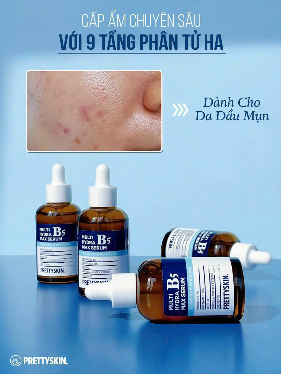 Kho sỉ serum B5 Prettyskin Multi Hydra Max Serum Cho Da Dầu Mụn 50ml Kho sỉ serum B5 Prettyskin Multi Hydra Max Serum Cho Da Dầu Mụn 50ml