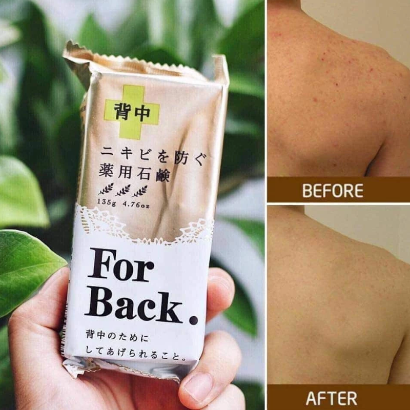 25517_xa-phong-mun-lung-phu-photoroom-3_20241026142112-1.png Xà Phòng Pelican For Back 135g Hỗ Trợ Giảm Mụn Lưng - 4976631894225