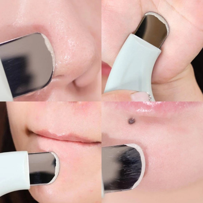 25804_thanh-day-mun-ilso-photoroom-4_20241122163154-2.png Cây Đẩy Mụn Đầu Đen ILSO Deep Clean Master Hàn Quốc - Thanh Gạt Mụn & Sợi Bã Nhờn - ILSO01