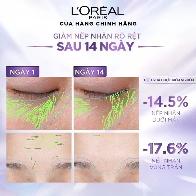 25814_kem-face-loreal-tim-phu-photoroom-3_20241123161020-2.jpg Kem Dưỡng Siêu Cấp Ẩm Loreal Paris Revitalift Hyaluronic Acid Line Filling Water 50ml - 6923700981209