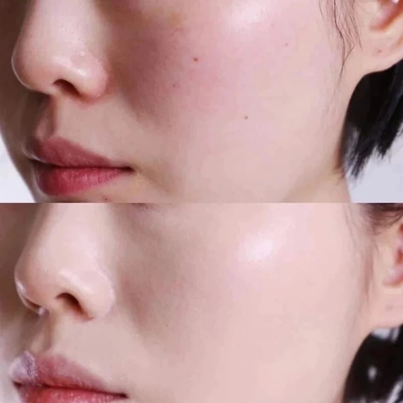 25838_kcn-sjm-phu-photoroom-2_20241129115443-1.png Kem chống nắng SJM Medical Anti UV Perfect SunScreen SPF50+/PA++++ 60ml - 8809297387427