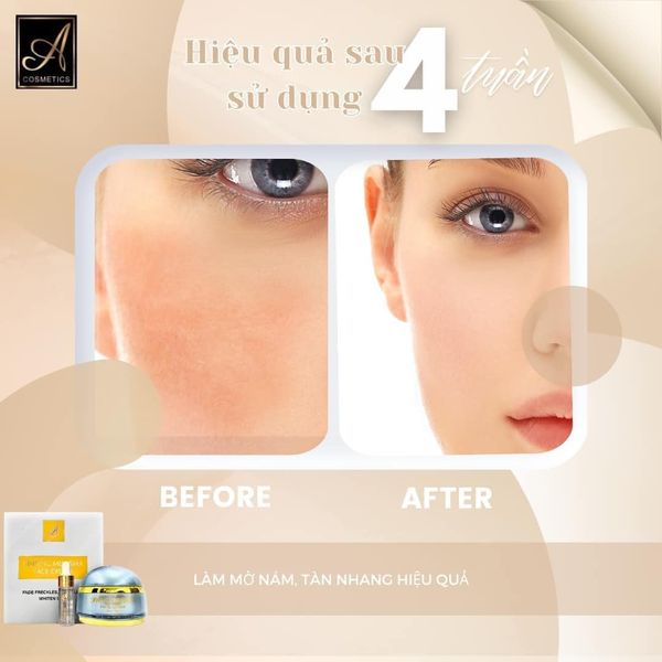 Face Serum Nám Nhân Sâm A Cosmetics Ginseng Melasma Mỹ Phẩm Phương Anh