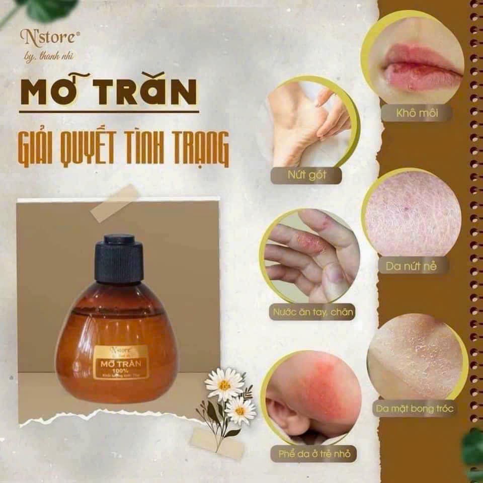 Nguồn gốc mỡ trăn nguyên chất  N'storeMỡ trăn N'store là sản phẩm của Công ty TNHH TMDV Thanh Nhi N’store.
