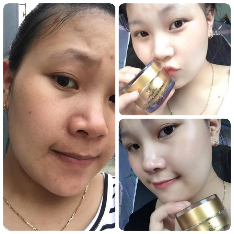 Combo dưỡng da, phục hồi hư tổn da (gồm Kem face Collagen x3 và Serum Collagen x3)