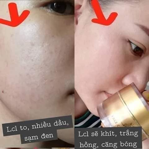 KEM FACE COLLAGEN X3 có gì hot?