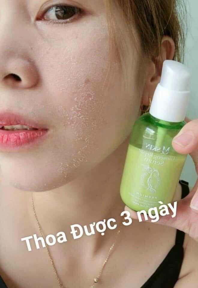 Serum tái tạo da không sưng nhân sâm MQ Skin