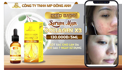 Serum trị mụn Collagen X3 chính hãng Mỹ Phẩm Đông Anh