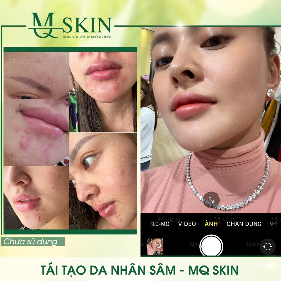 Vì sao "BB Cream tái tạo da MQ Skin" gây siêu bão trên thị trường?