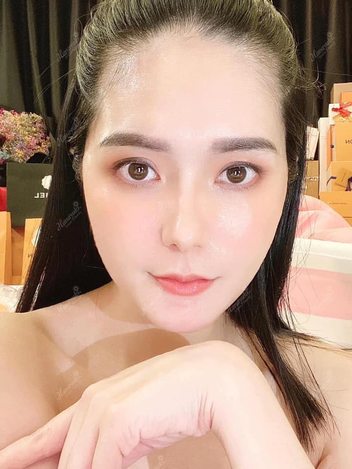 1 liệu trình 4 công dụng hiệu quả sau 7 ngày dùng với Hana Acnes