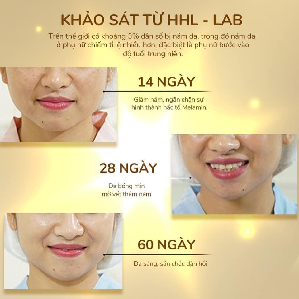 Kem Dưỡng Huyết Yến Phục Hồi KB One