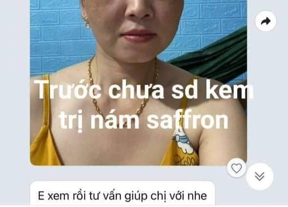 Kem Face Trị Nám Dưỡng Trắng Da Saffron Napoli Hải Âu Việt