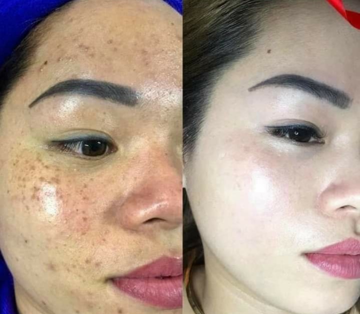 Kem Face Trị Nám Dưỡng Trắng Da Saffron Napoli Hải Âu Việt