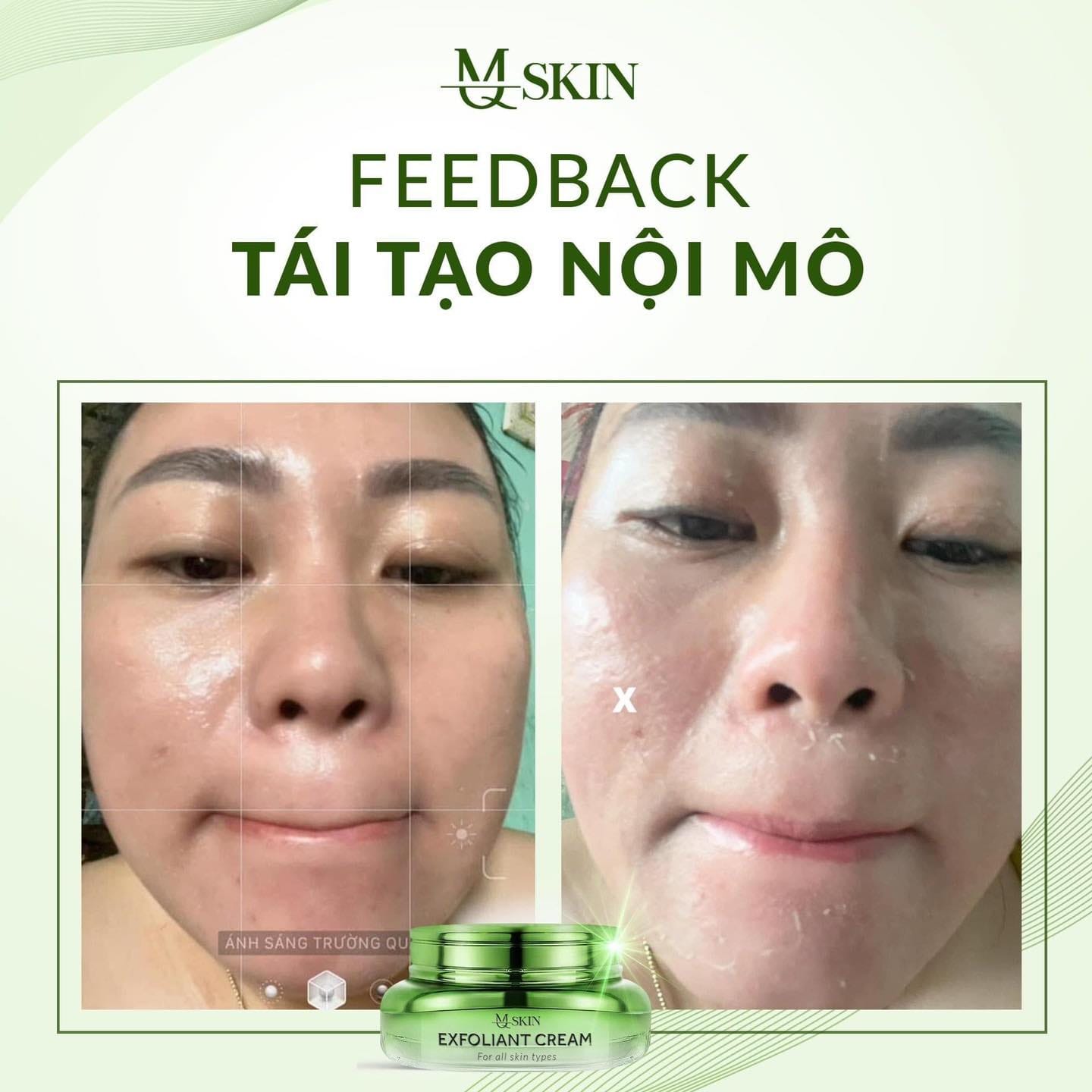 Tái tạo nội sinh MQ Skin chuẩn bị bùng nổi trên thị trường 2023