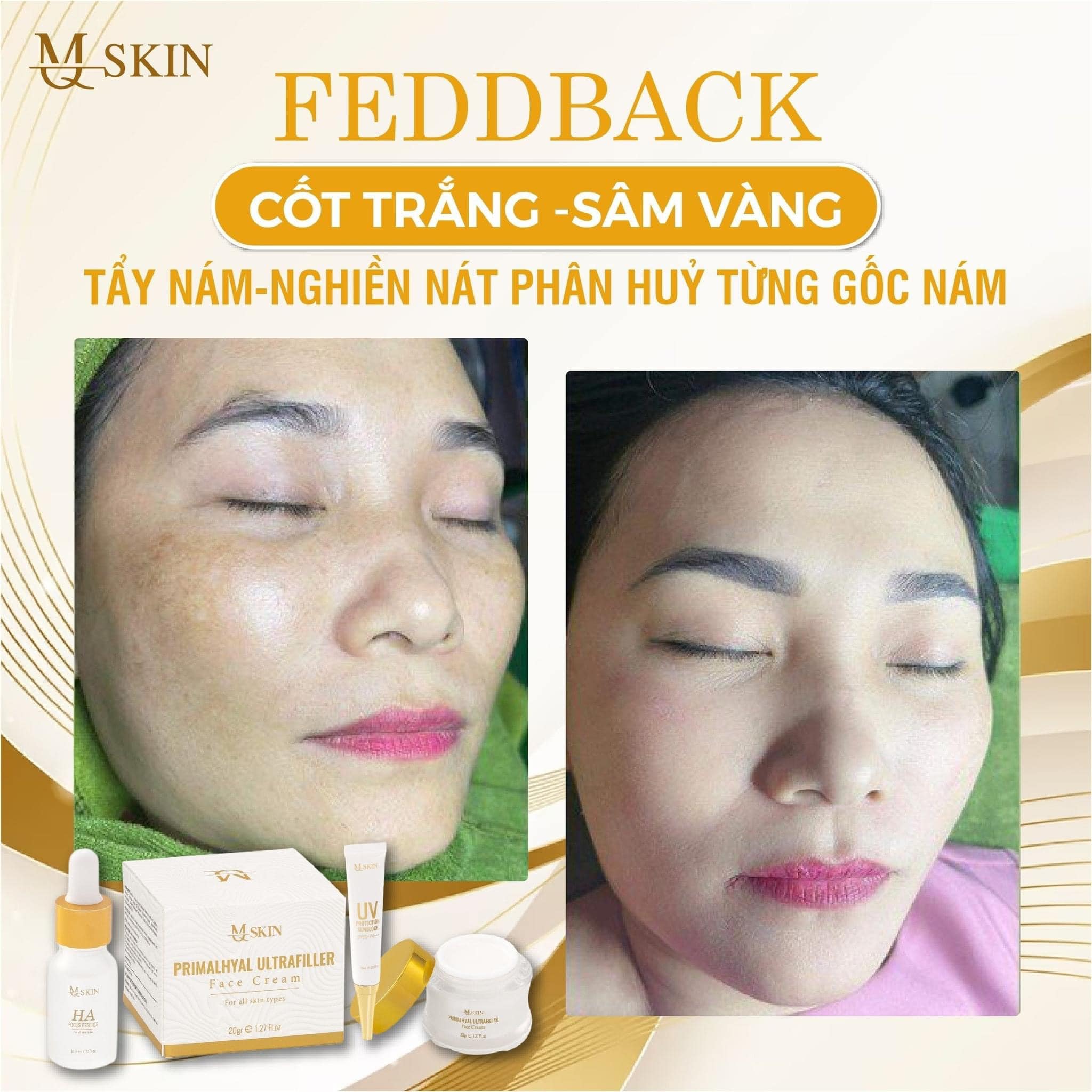 Bộ nám Sâm Vàng  điều trị nám tàn nhang da không đều màu lỗ chân lông to đồi mồi