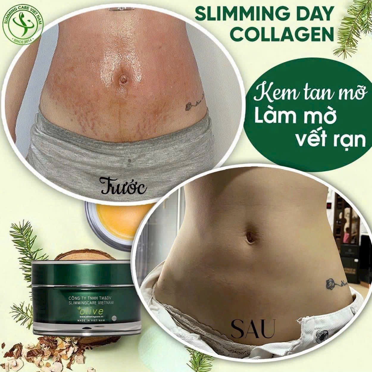 Ca sĩ diễn viên Minh Hằng cũng giao niềm tin cho  SlimmingCare và nhận về kết quả ngoài sức mong đợi chỉ sau sinh 2 tháng 7 ngày