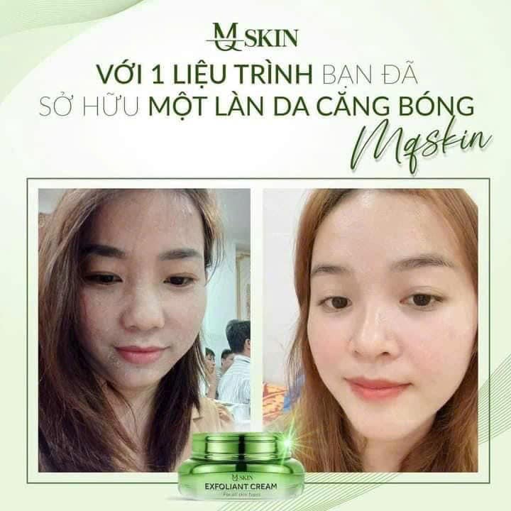 Kem Face Tái Tạo Nội Sinh Exfoliant Cream MQ Skin Tặng Kem Dưỡng HA