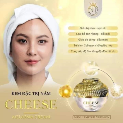 Da đẹp đón Tết xinh cùng Kem Face Nám Melasma Cheese NT Cosmetics