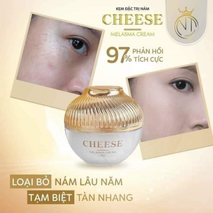 Da đẹp đón Tết xinh cùng Kem Face Nám Melasma Cheese NT Cosmetics