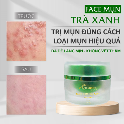 Kem Face Giảm Mụn Tinh Chất Trà Xanh N Collagen